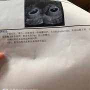 孕期查男女（孕期查男女）