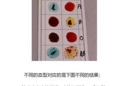 新生儿上户口血型证明到哪里开,胎儿血型怎么查 无创