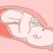 横位胎儿妈妈怎么睡（横位胎儿是什么姿势）