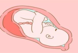 横位胎儿妈妈怎么睡（横位胎儿是什么姿势）