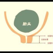 孕期宫颈长度（怀孕24周宫颈管多长是正常）