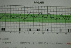 胎儿心跳过快怎么办（胎儿心跳过快怎么办怎么解决）
