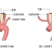 胎儿迷（胎儿迷走右锁骨下动脉什么意思）
