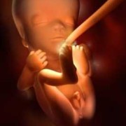 30周如果胎儿头的位置还没有朝下该怎么解决啊,怀孕30周真实胎儿图片 图片欣赏