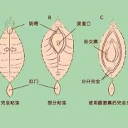 孕期阴道口痒怎么办（孕妇下面痒会影响胎儿吗）