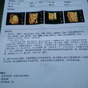 四维图新是什么导航,孕期四维图片