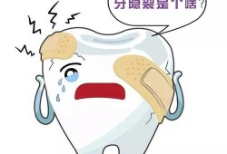 孕期蛀牙疼痛（孕期蛀牙疼痛难忍怎么缓解）