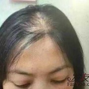 孕期头发变多,怀孕期间掉头发正常吗女性