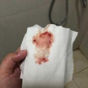 怀孕三个多月同房流血是怎么回事,孕期行房出血怎么办