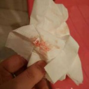 怀孕初期有轻微出血怎么回事,早孕期间出血是怎么回事