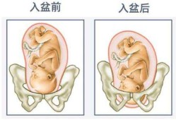 怀孕多少周胎儿入盆,一般孕多少周胎儿入盆