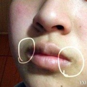 孕期嘴角发黑（【嘴角发黑去掉方法有哪些】）