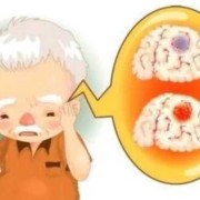 胎儿小脑萎缩（胎儿小脑萎缩怎么回事）