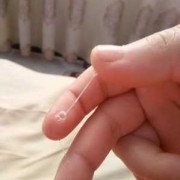 孕期白带拉丝（受精卵着床后会出现白带拉丝吗）