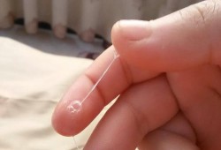 孕期白带拉丝（受精卵着床后会出现白带拉丝吗）