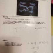 怀孕初期先兆流产孩子能保住吗,先兆流产能保住的几率有多大