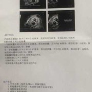 胎儿心率159（胎儿心率159是男孩女孩）