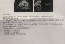 胎儿心率159（胎儿心率159是男孩女孩）