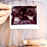 胎儿头在左边（胎儿头在左边还能左侧睡吗）