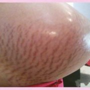 悬浮肚胎儿（悬浮肚胎儿在肚子里什么样子）