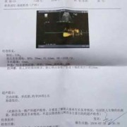 助产术名词解释,胎儿倒转术一般多少钱