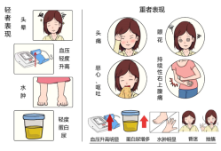 孕期子癫是什么引起的（妊娠高血压症是怎么回事）