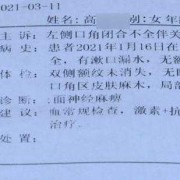 你好，我怀孕8个月患面瘫，该怎么治,孕期面瘫对胎儿有影响吗