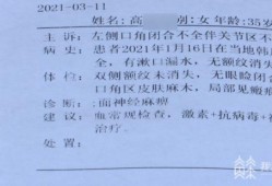 你好，我怀孕8个月患面瘫，该怎么治,孕期面瘫对胎儿有影响吗