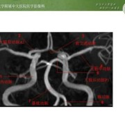 胎儿C型血管环（大脑willis环为什么叫willis环）