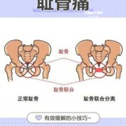 孕期耻骨疼（孕期耻骨疼有什么办法缓解）
