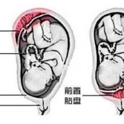 胎儿前壁和后壁的区别,胎儿在子宫前壁和后壁有什么区别