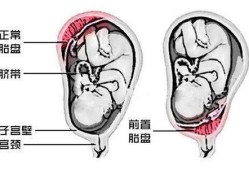胎儿前壁和后壁的区别,胎儿在子宫前壁和后壁有什么区别
