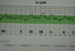 胎儿胎心（胎儿胎心多少算正常）