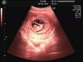 怀孕50天的胎儿图片（孕45天胎儿发育情况到底是怎样的？孕早期时候，需要怎么检查）