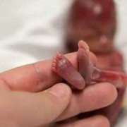 孕妇死亡胎儿会死吗（孕妇死亡胎儿会死吗视频）