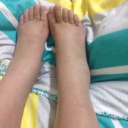 孕期脚酸软（孕期脚酸软是怎么回事）