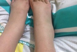孕期脚酸软（孕期脚酸软是怎么回事）
