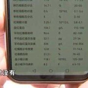 怀孕要做哪些检查项目,怀孕1-10个月检查表