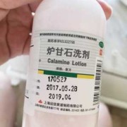孕期经常湿疹怎么办（怀孕以后身上长了许多湿疹，可以涂什么药膏）
