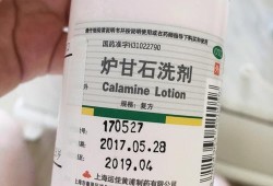 孕期经常湿疹怎么办（怀孕以后身上长了许多湿疹，可以涂什么药膏）