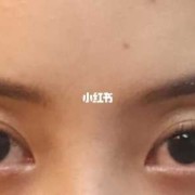 胎儿眼窝深（胎儿眼窝深是不是眼睛就大）