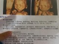 23周男女胎儿区别图（23周的三维宝宝的数据都在正常指标吗?需要注意什么）