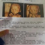 23周男女胎儿区别图（23周的三维宝宝的数据都在正常指标吗?需要注意什么）