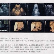 怀孕25周，胎宝头偏大要紧么,胎儿头围偏大是男孩吗还是女孩