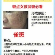 防止长斑的正确方法,孕期预防长斑的方法