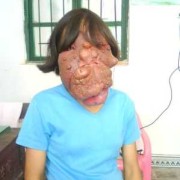 胎儿畸形是什么意思？什么原因导致的,胎儿先天畸形在围产儿死亡中占第一位的是