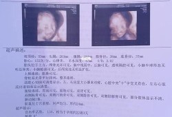 孕期不忌嘴（孕期不忌嘴唐筛四维都过了胎儿）