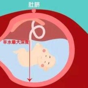 孕妇羊水少对胎儿有什么影响,孕期羊水少对胎儿影响大吗