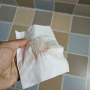 孕期梦见见红了（孕期梦见见红了）