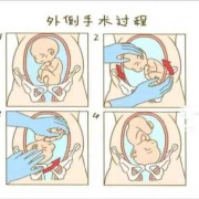 如何让胎儿快速发动（38周了如何让胎儿快速发动）